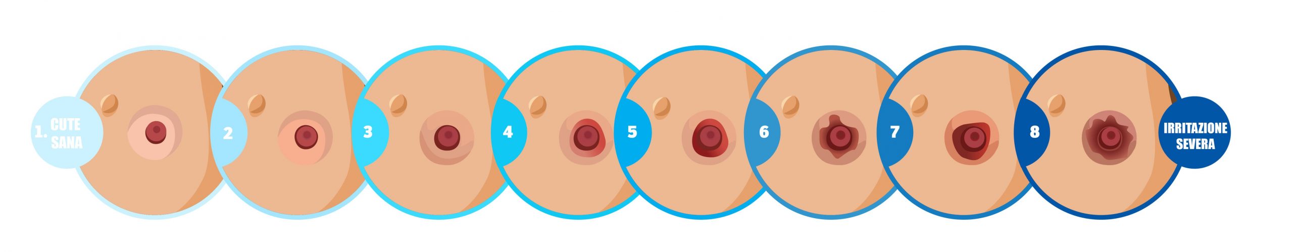 Alterazione della pelle peristomale in fasi