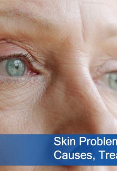 Skin Problems with Elderly: Causes, Treatments and Prevention