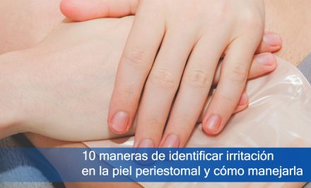 10 maneras de identificar irritación en la piel periestomal y cómo manejarla