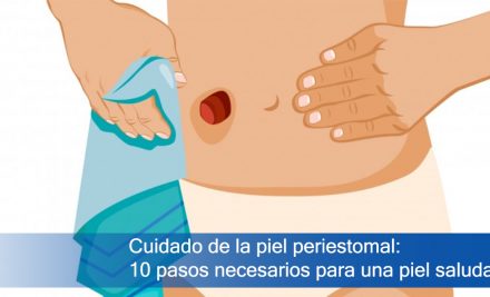 Cuidado de la piel periestomal: 10 pasos necesarios para una piel saludable