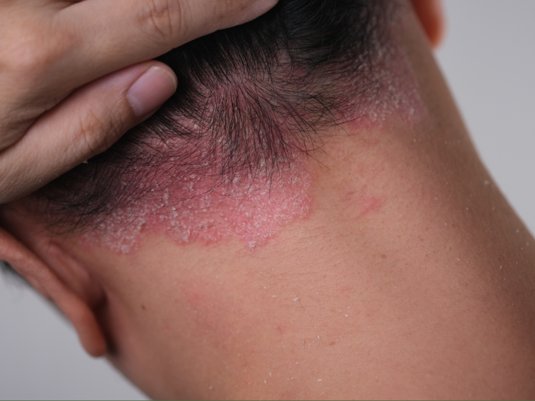 atap-26-03-ig-share (2)